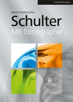 Schulter – MR-Tomographie