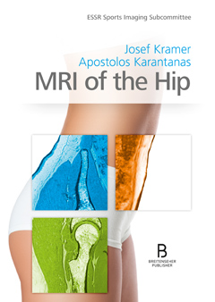 MRI of the Hip