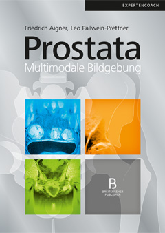 Prostata