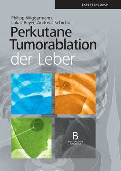 Perkutane Tumorablation der Leber