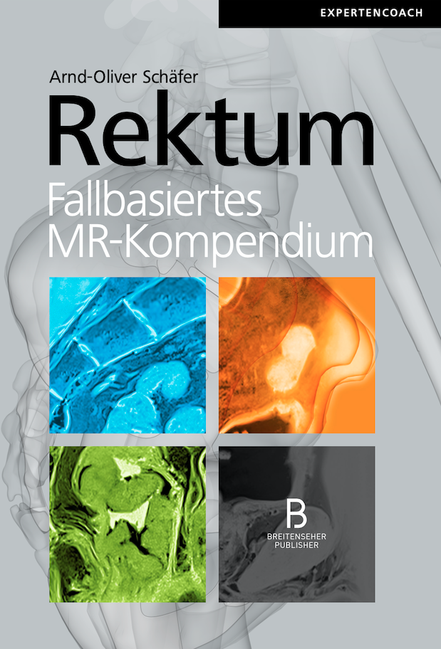 Rektum - Fallbasiertes MR-Kompendium