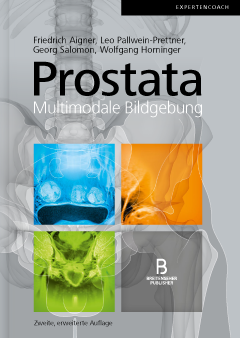 Prostata