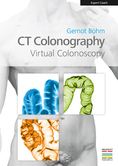 CT Colonography, Virtual Colonoscopy